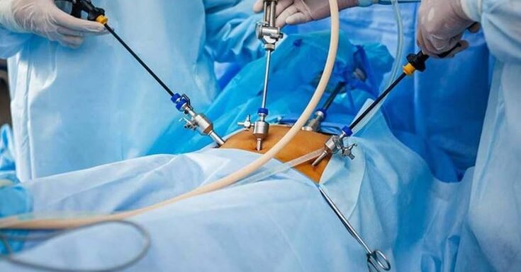 Best Prostate Surgeon in Old Gurgaon